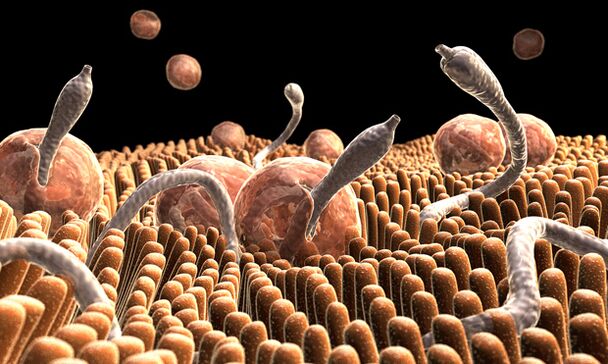 Pinworms kerekesférges férgek kezelése - Tinktúra üröm parazitákból hogyan kell venni